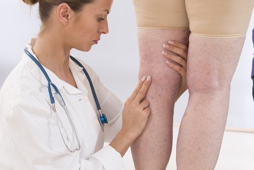 Medic examinând picioarele unei femei