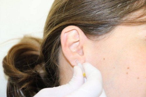 Auriculoterapia pentru boala Parkinson la femei