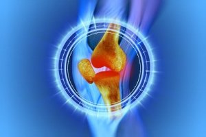 Recuperarea genunchiului după operația de menisc