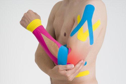 Tehnica kinesio taping aplicată pe braț