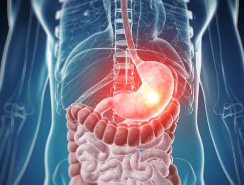 Care sunt principalele intoleranțe alimentare?