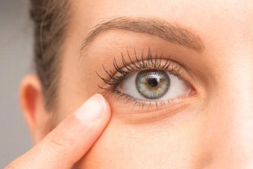 De unde vin ridurile de sub ochi? Cum să elimini ridurile de sub ochi?