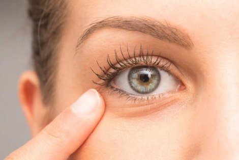 Cearcane si pungi sub ochi - 7 remedii naturale la indemana oricui