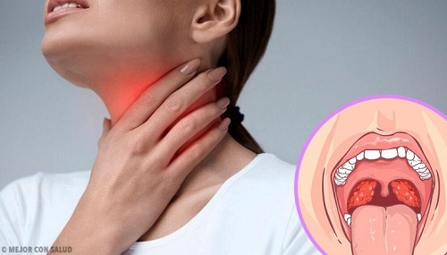 Femeie care are nevoie de un tratament pentru abcesul dentar