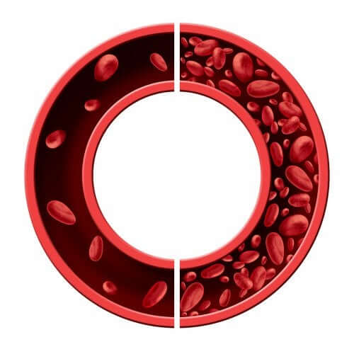 5 remedii pentru anemia prin carență de fier