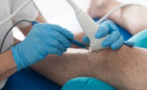 Medic ce explică de ce osteoartrita cauzează durerea la genunchi