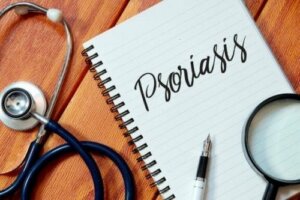 Modalități de a ameliora psoriazisul