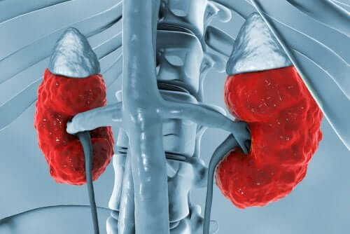 Cauzele acidozei tubulare renale proximale