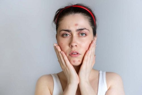 Femeie speriată de acneea în timpul menstruației