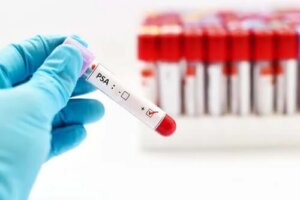 Informații despre examenul de prostată
