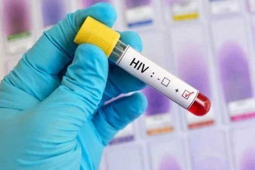 Proceduri de combatere a HIV și SIDA
