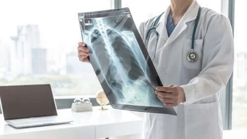 Medic care analizează infecția cu coronavirus și astmul