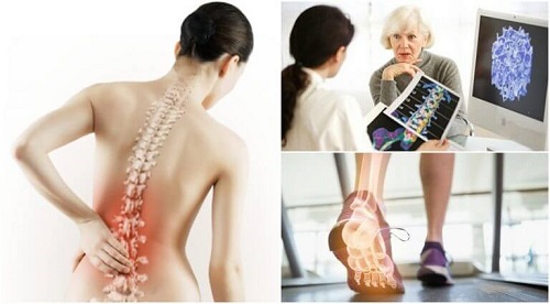 Oase atacate de afecțiuni care provoaca dureri de spate