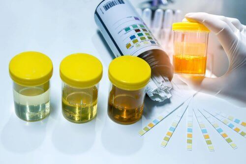 Probe de urină în recipiente sterile