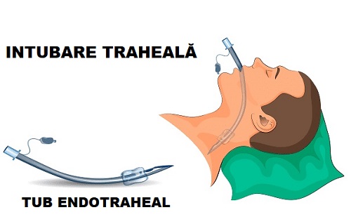 Instrucțiuni pentru utilizarea diferitelor tipuri de tuburi endotraheale