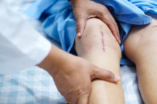 Recuperarea după artroplastia de genunchi