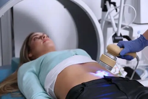 Medic care aplică un tratament pentru sindromul ovarelor polichistice