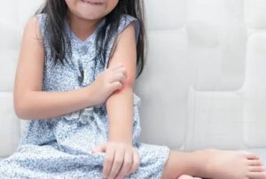 Psoriazisul la copii: cum să-i faci față