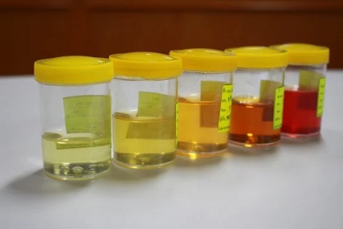 Schimbările la nivelul urinei: motive de îngrijorare
