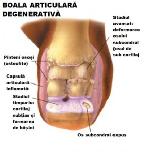 Boala articulară degenerativă: cauze și tratament