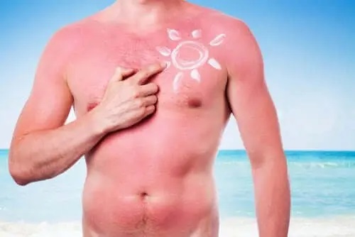 Efectele nocive ale soarelui asupra pielii