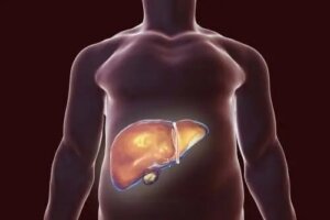 Cea mai bună dietă pentru vezica biliară