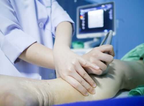 Tromboza venoasă profundă: detectare și prevenire