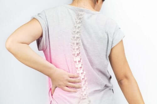 Pacient experimentând o durere de spate cauzată de scolioză