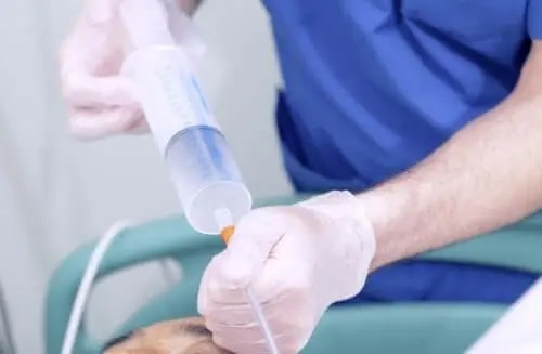 Cadru medical ce schimbă tubul de hrănire