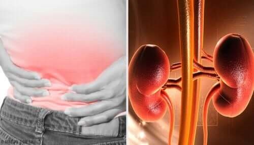 Pacient care are nevoie de tratamente pentru abcesul renal