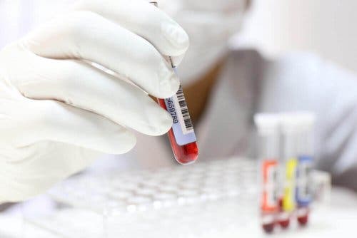 Asistent de laborator analizând probe de sânge