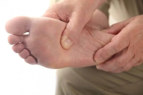Bărbat cu picior diabetic