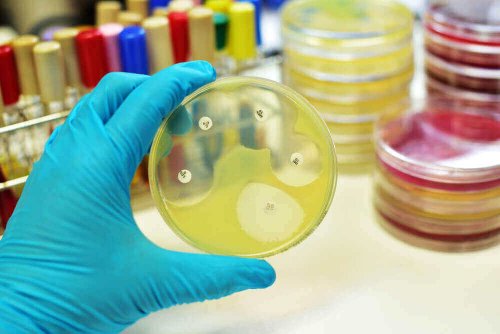 Specialist care analizează o cultură de bacterii