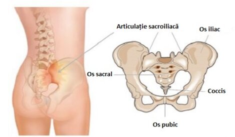 durere în cauzele articulației sacroiliace