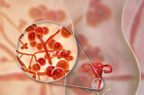 Infecția cu Mycoplasma genitalium: tratament