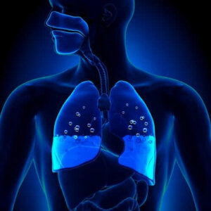 Cauze și simptome ale edemului pulmonar