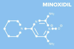 Tratament pentru alopecie cu minoxidil