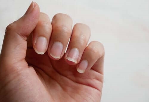 Tratamente pentru unghiile fragile 100% naturale