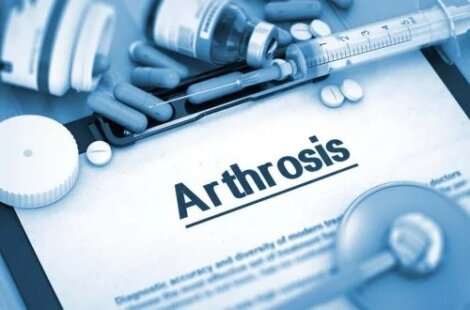 Tratamentul artrozei cu arcoxia tratament articular pentru inflamație