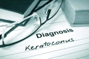 Caracteristici și tratamente pentru keratoconus