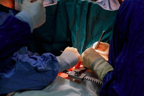 Echipă medicală în toiul unei intervenții chirurgicale