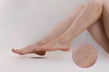 Exerciţii fizice pentru combaterea umflării picioarelor şi a venelor varicoase | Lioton® Gel