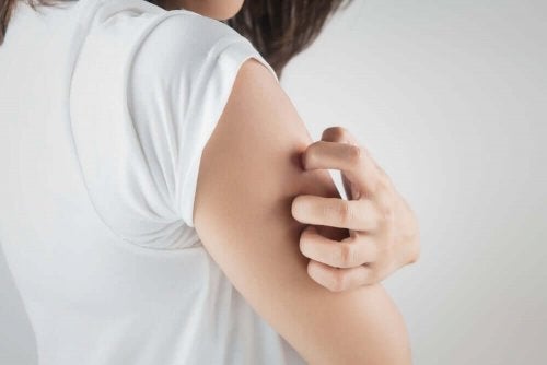 Femeie scărpinându-se din cauza unor mâncărimi la nivelul brațului