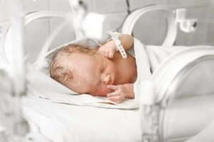Gastroschizis la nou-născuți: un defect congenital