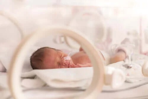 Gastrochizis la nou-născuți prematuri
