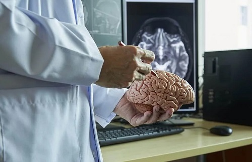 Medic care examinează o machetă de creier