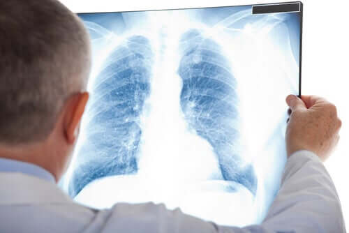 Medic studiind o radiografie toracică