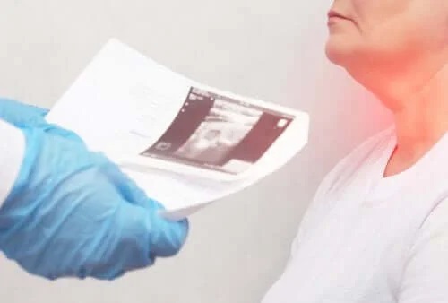 Cauzele și simptomele nodulilor tiroidieni