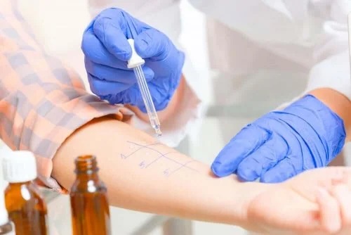 Medic care face un test de alergii