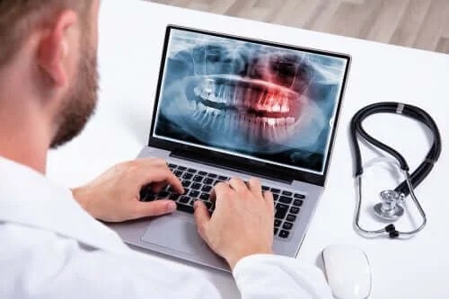 Cauze și tratamente pentru hiperdonție